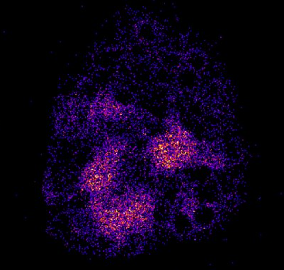 Snapshot in time of lymph node dosimetry on 12 micrometer pixels